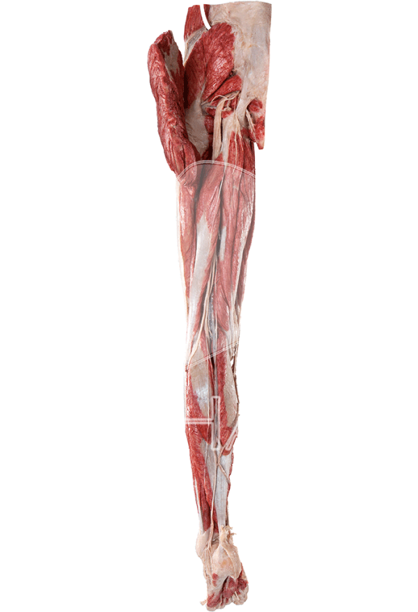 Lower Extremity – without Reproductive Organs - Image 3