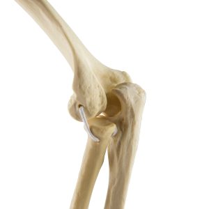 3B ORTHObones Standard