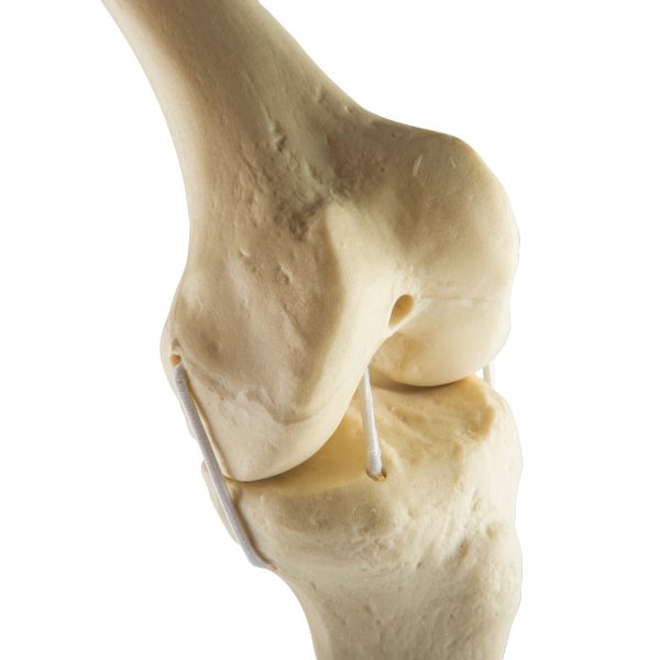 ORTHObones Standard Knee left