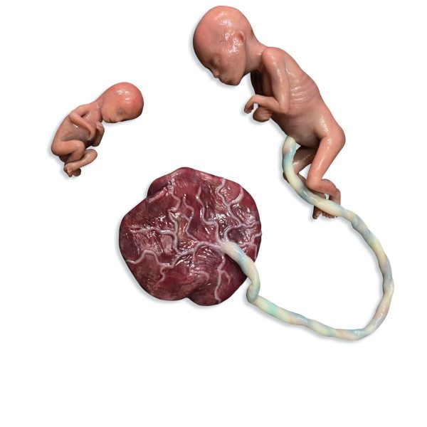 Miscarriage Manikin 