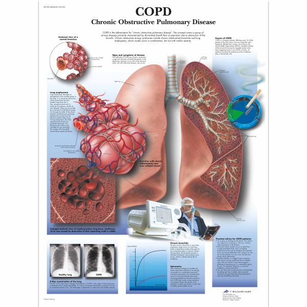 COPD Chart - Chronic Obstructive Pulmonary Disease