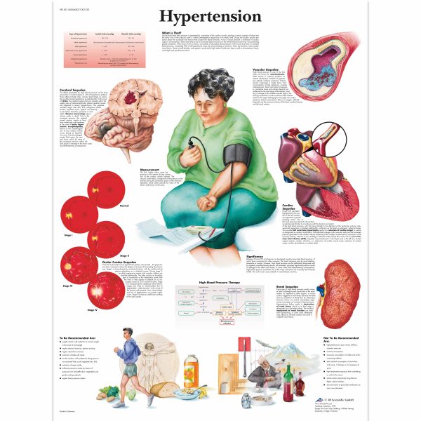 Hypertension Chart