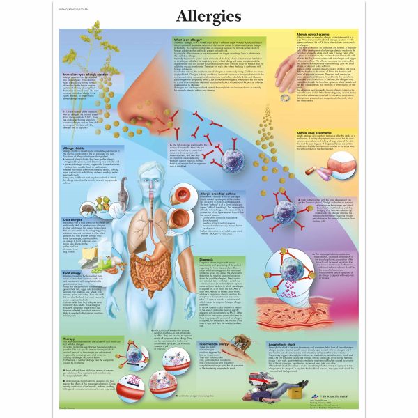 Allergies Chart