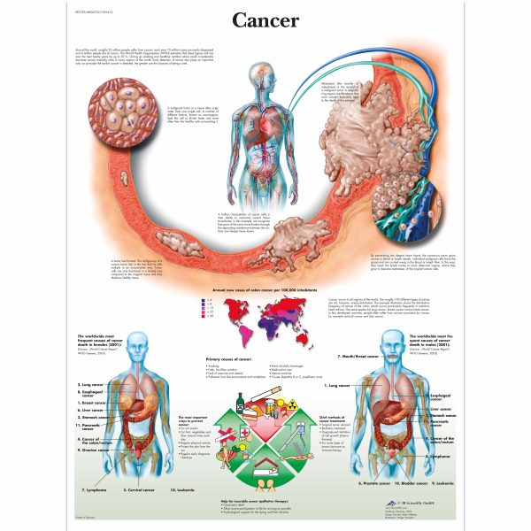 Cancer Chart