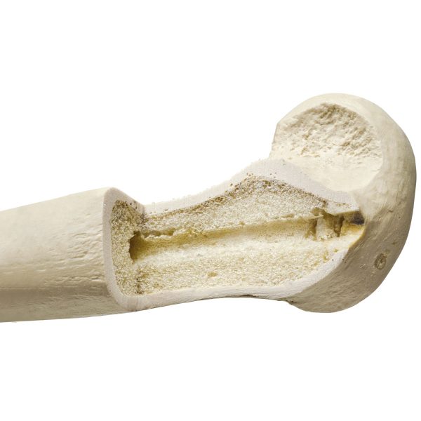 ORTHObones Premium Left Radius