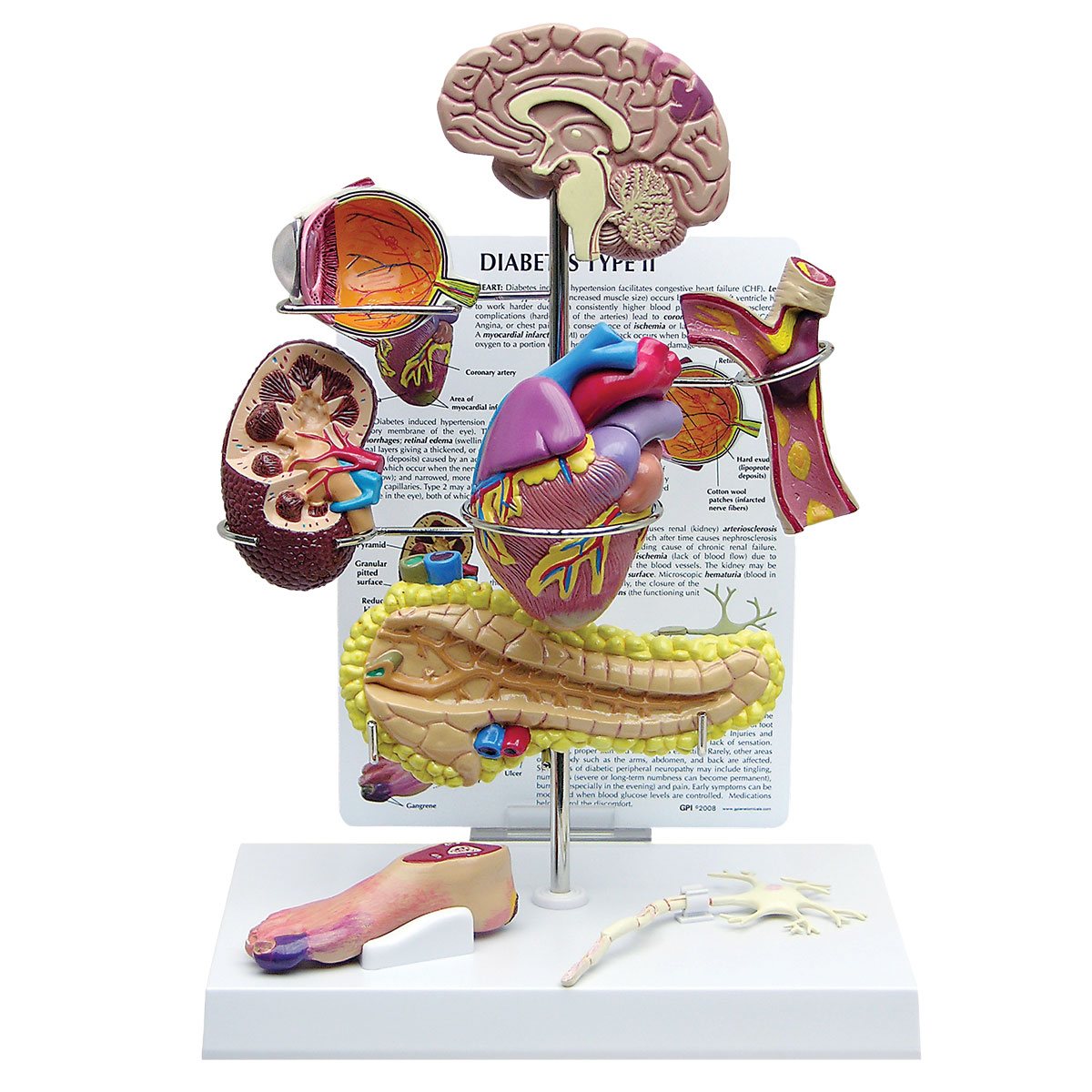 Type II Diabetes Set